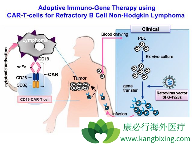 cart疗法为血液肿瘤的治疗带来了新希望