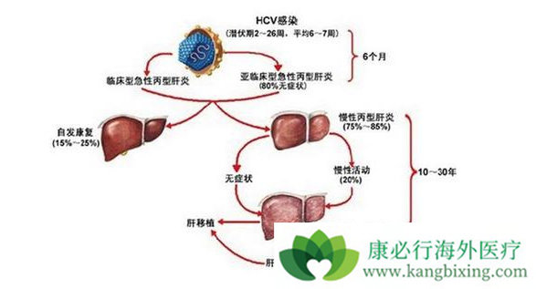 每一種療法所用的費用也不同,而且不同的醫院也會有不同的費用,丙肝