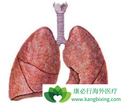 肺纤维化能治愈吗图片